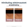 EUCERIN ANTI-PIGMENT szemránckrém 15 ml