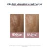 EUCERIN ANTI-PIGMENT DUAL szérum 30 ml